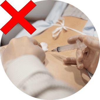 Infiltrazioni di cortisone